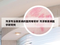 菏泽专治银屑病的医院哪家好 菏泽银屑病医学研究院