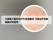 江西哪个医院治疗牛皮癣最好 江西治疗皮肤病最好的医院