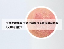 下肢皮肤皮癣 下肢长癣是什么原因引起的呢?又如何治疗?