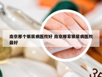 南京那个银屑病医院好 南京哪家银屑病医院最好