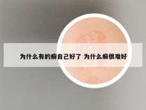 为什么有的癣自己好了 为什么癣很难好