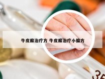 牛皮廨治疗方 牛皮廨治疗小偏方