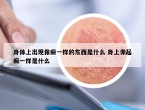 身体上出现像癣一样的东西是什么 身上像起癣一样是什么