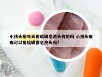 小孩头癣每天用硫磺皂洗头有用吗 小孩头皮痒可以用硫磺香皂洗头吗?