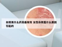 白斑用什么药膏最有效 女性白斑是什么原因引起的