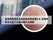 染发剂弄到手上起白色点斑点是什么 染发剂弄手上起了小白点是什么原因