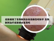 皮肤病用了生物制剂会有依赖性吗知乎 生物制剂治疗皮肤病会复发吗