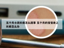 五个月小孩长癣怎么回事 五个月的宝宝身上长癣怎么办