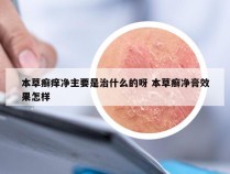 本草癣痒净主要是治什么的呀 本草癣净膏效果怎样