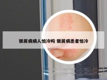 银屑病病人怕冷吗 银屑病患者怕冷