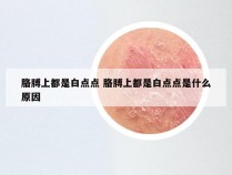 胳膊上都是白点点 胳膊上都是白点点是什么原因