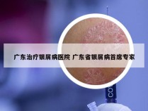 广东治疗银屑病医院 广东省银屑病首席专家