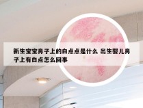 新生宝宝鼻子上的白点点是什么 出生婴儿鼻子上有白点怎么回事