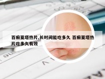 百癣夏塔热片,长时间能吃多久 百癣夏塔热片吃多久有效