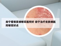 南宁看银屑病哪家医院好 南宁治疗皮肤病医院哪家好点