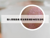 情人得银屑病 男友银屑病影响性生活吗