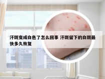 汗斑变成白色了怎么回事 汗斑留下的白斑最快多久恢复