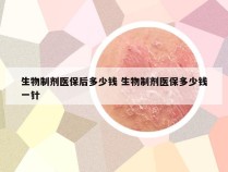 生物制剂医保后多少钱 生物制剂医保多少钱一针