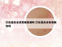 打白蛋白会诱发银屑病吗 打白蛋白会有依赖性吗