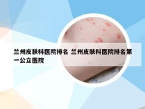 兰州皮肤科医院排名 兰州皮肤科医院排名第一公立医院