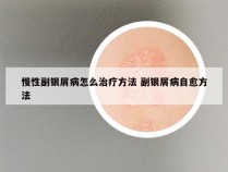 慢性副银屑病怎么治疗方法 副银屑病自愈方法