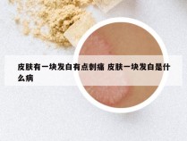 皮肤有一块发白有点刺痛 皮肤一块发白是什么病