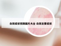 白斑症状初期图片大全 白斑主要症状