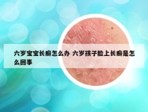 六岁宝宝长癣怎么办 六岁孩子脸上长癣是怎么回事