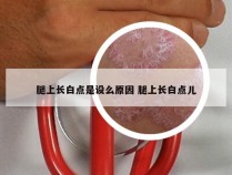 腿上长白点是设么原因 腿上长白点儿