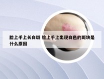 脸上手上长白斑 脸上手上出现白色的斑块是什么原因