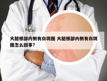 大腿根部内侧有白斑图 大腿根部内侧有白斑图怎么回事?