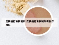 皮肤病打生物制剂 皮肤病打生物制剂有副作用吗