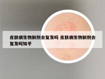 皮肤病生物制剂会复发吗 皮肤病生物制剂会复发吗知乎