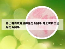 身上有白斑并且痒是怎么回事 身上有白斑还痒怎么回事