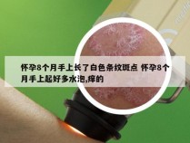 怀孕8个月手上长了白色条纹斑点 怀孕8个月手上起好多水泡,痒的