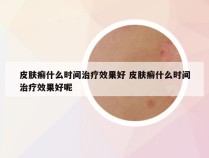 皮肤癣什么时间治疗效果好 皮肤癣什么时间治疗效果好呢