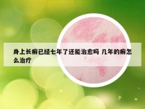 身上长癣已经七年了还能治愈吗 几年的癣怎么治疗