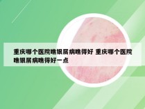 重庆哪个医院瞧银屑病瞧得好 重庆哪个医院瞧银屑病瞧得好一点