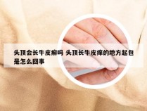 头顶会长牛皮癣吗 头顶长牛皮痒的地方起包是怎么回事