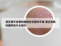 宿迁是牛皮癣科医院优先楚街不错 宿迁皮肤科医院在什么地方