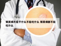 银屑病不能干什么不能吃什么 银屑病都不能吃什么