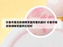 长春市看皮肤病哪家医院看的最好 长春市看皮肤病哪家医院比较好