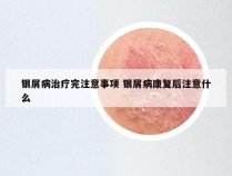 银屑病治疗完注意事项 银屑病康复后注意什么