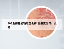 909金癣克的功效怎么样 金癣克治疗什么的