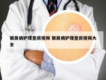 银屑病护理查房视频 银屑病护理查房视频大全