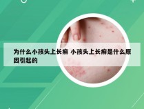 为什么小孩头上长癣 小孩头上长癣是什么原因引起的