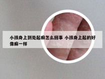 小孩身上到处起癣怎么回事 小孩身上起的好像癣一样