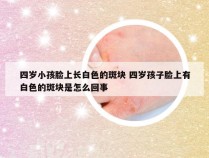 四岁小孩脸上长白色的斑块 四岁孩子脸上有白色的斑块是怎么回事