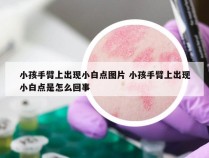 小孩手臂上出现小白点图片 小孩手臂上出现小白点是怎么回事