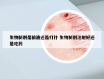 生物制剂是输液还是打针 生物制剂注射好还是吃药